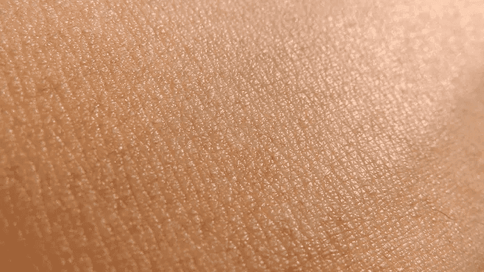 Nessuna lassità cutanea image