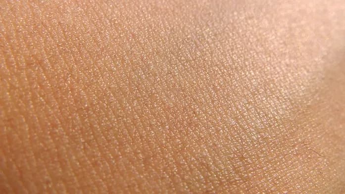 Senza cicatrici vistose image